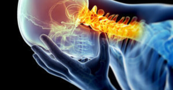 Concussions After An Accident image