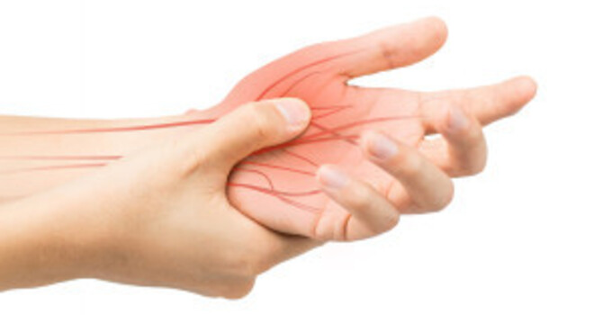 Understanding Nerve Pain image