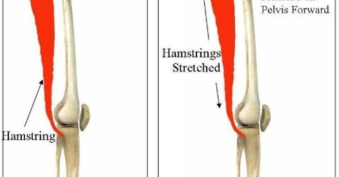 When Tight Does Not = Stretch: A closer look at hamstring “tightness” image