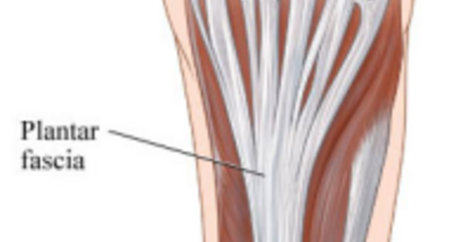 Plantar Fasciitis: Important Fact Sheet for Runners image